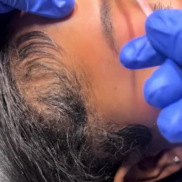 Indulge in Radiant Beauty: Face and Eyebrow Waxing with Sexy Smooth Tickled Pink Wax! 💆‍♀️✨