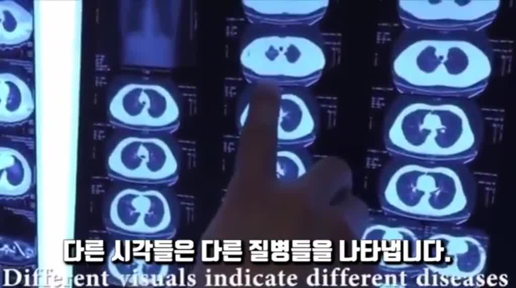 5G는 방사능 질환을 야기시킵니다. 그것은 코비드 19이며 심한 감기증상과 똑같다.