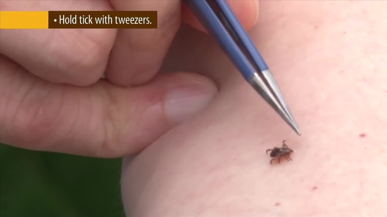 How to properly remove a tick