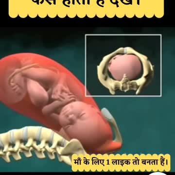 Normal Baby Delevery Home Tips Tray Don't Paying Money Hospital