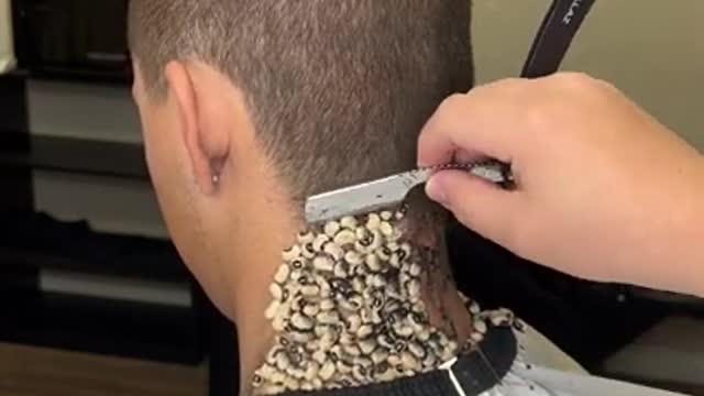 Ticks removal ! #shorts