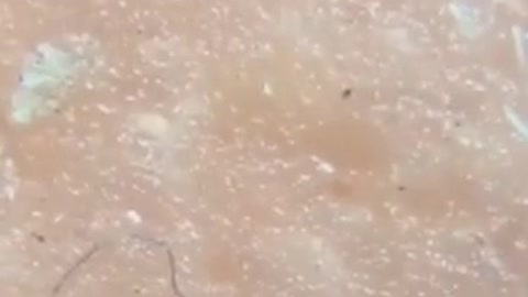 Hotdog microscope