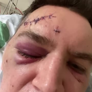 Dr. Szarpanki - atak dzikich zwierząt w Kebabie Istanbul w Mielnie