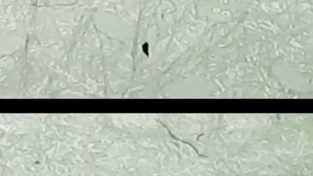 THERE IS MORGELLONS IN THE MASKS!