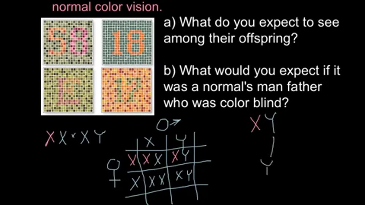 Color blindness: X chromosome linked inheritance