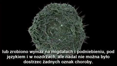 Germs are not infectious, 'zarazki' nie są zaraźliwe.