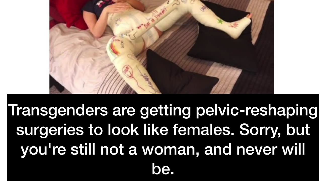 Transgenders are getting pelvic-reshaping surgeries to look like females.