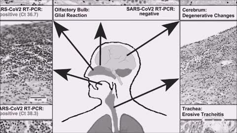 Priemysel ťažby ropy a plynu plánuje vymeniť zaočkovaných zamestnancov