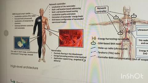 : SABRINA: WALLACE "BODY AREA NETWORK".