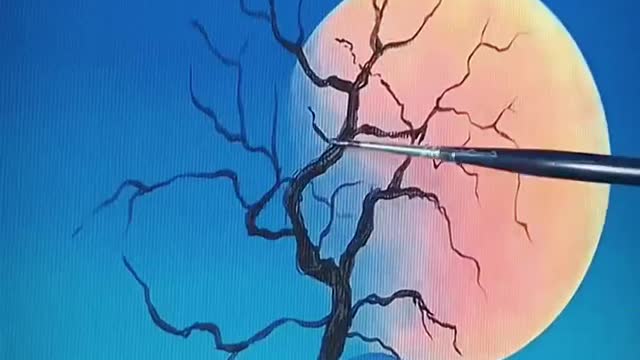How to Paint Moonlight Glow With Acrylics