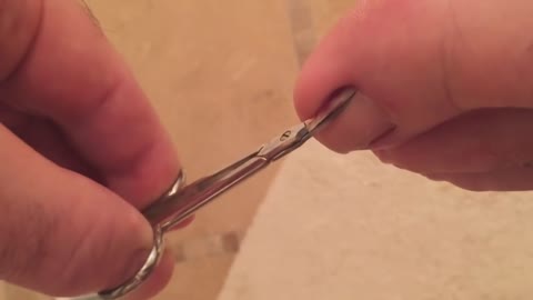 Removing ingrown nail satysfing