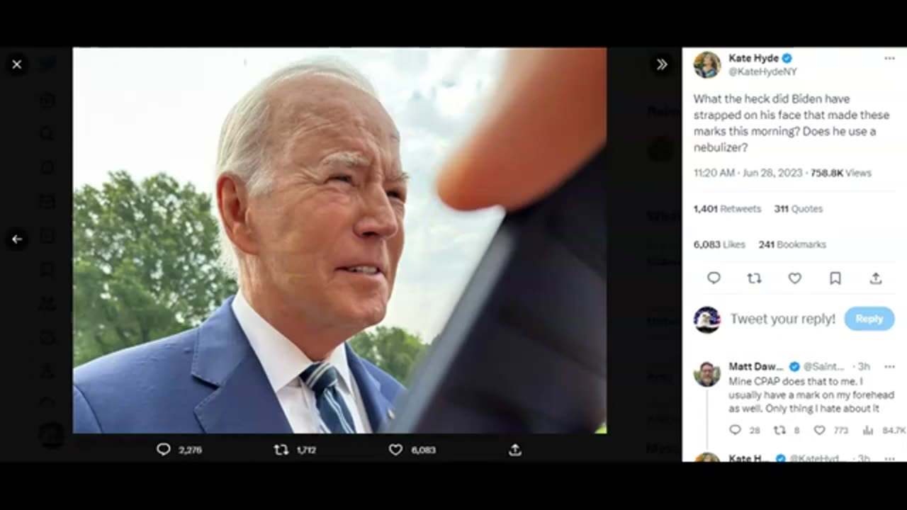 World News Report-Strange Indentations Seen On Joe Biden's Face Today Force White House Dislosure!