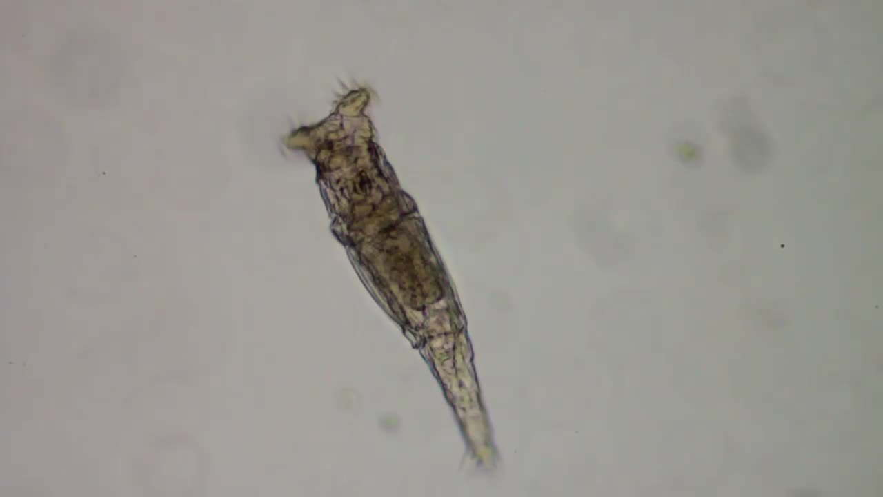 Bdelloid Rotifer Out for a Walk