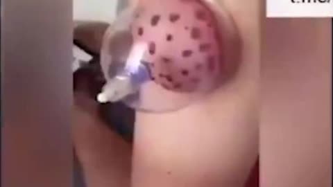 Blood congeals right in front of your own eyes.