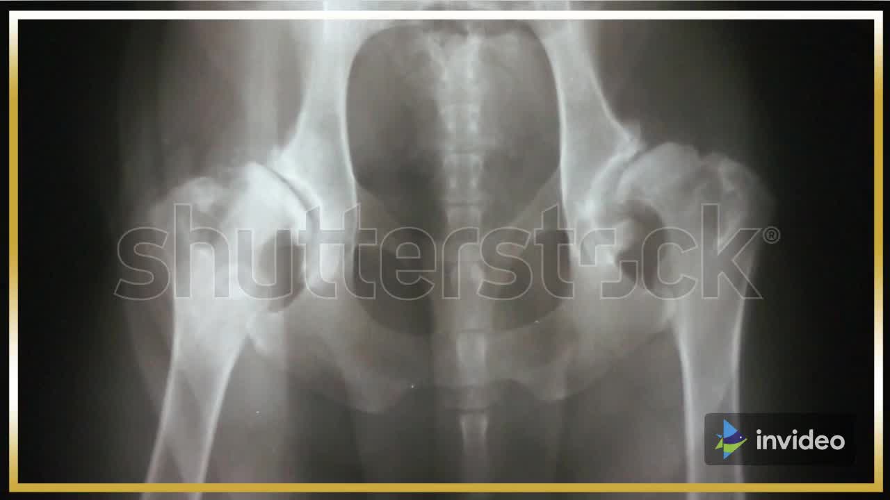 Tips for living well with Arthritis Part 3