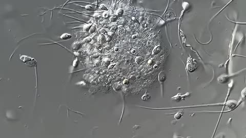 Sperm in microscope