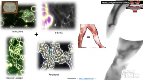 Reese Report on Thermal Imaging of Jab Recipients