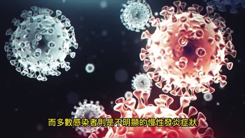 胃癌逾8成 幽門螺旋桿菌感染