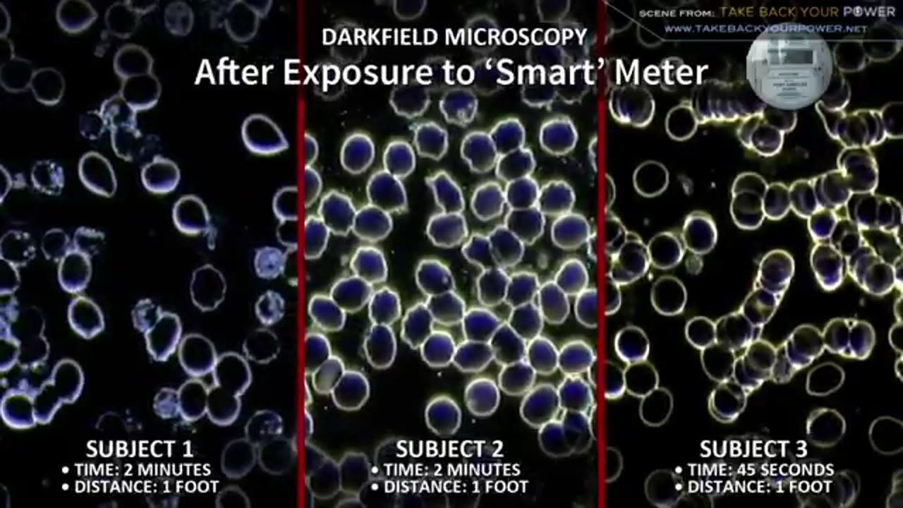 Live blood tests show the damage from smart meters, wi-fi, cell phones, 5G