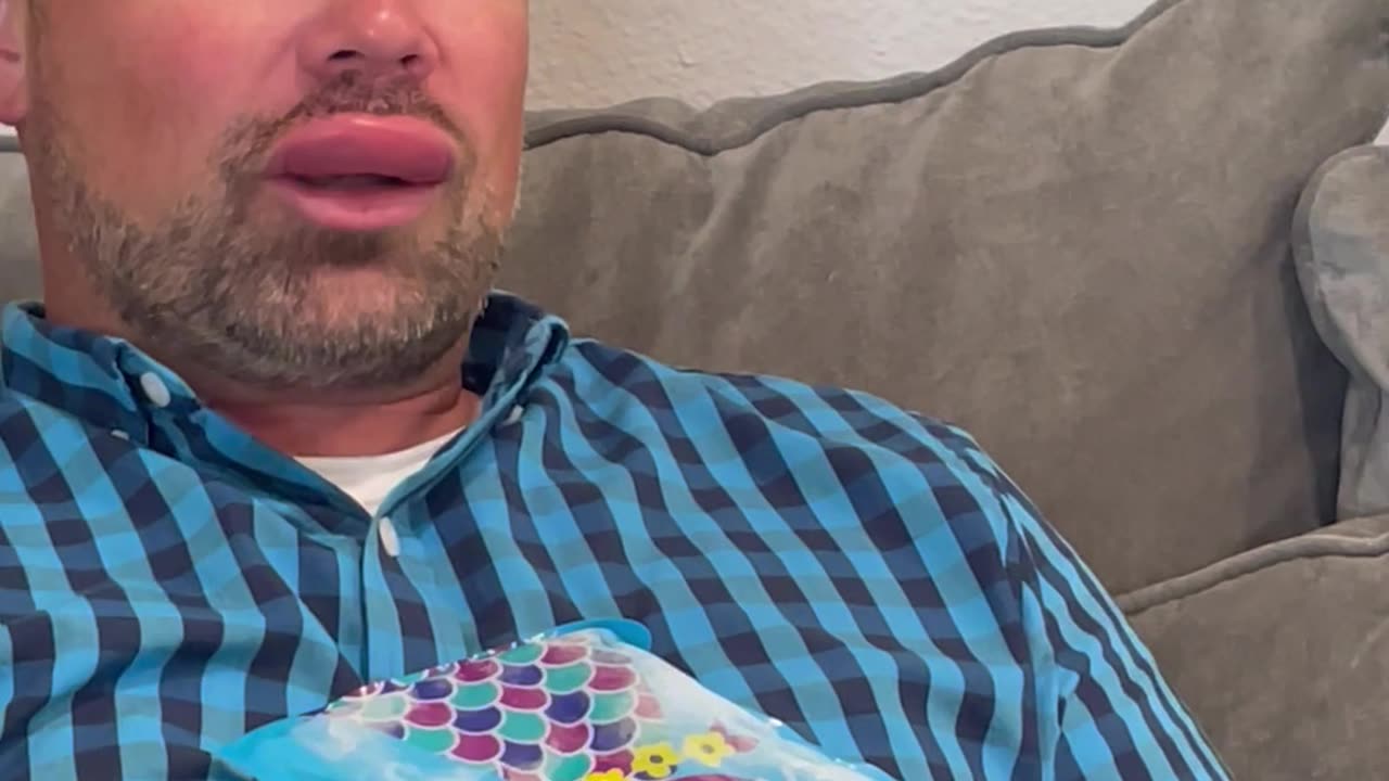 Husband Stung by a Wasp on His Lip