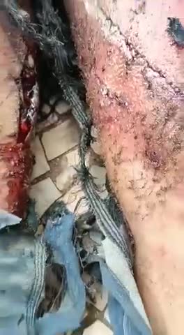 PATRIOTA ATACADO COVARDEMENTE PELA POLÍCIA EM MANIFESTAÇÃO DE BRASÍLIA