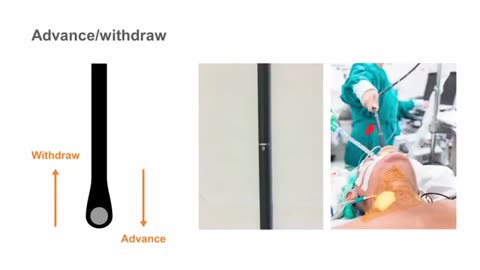 02. How to use the TEE probe—manipulating the probe position