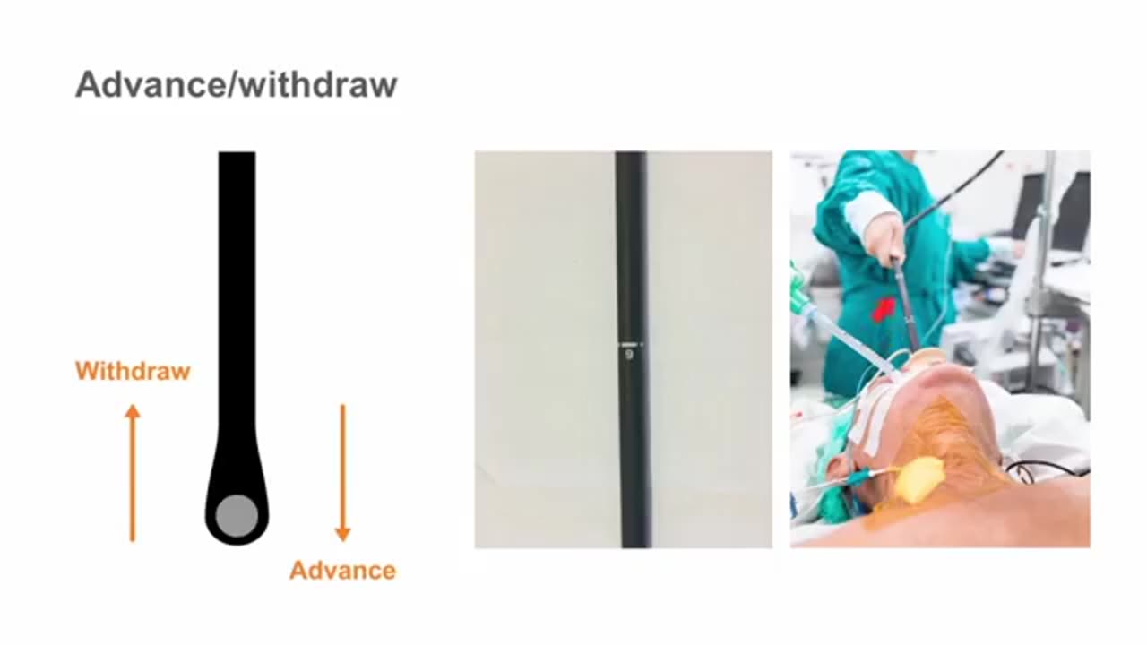 02. How to use the TEE probe—manipulating the probe position