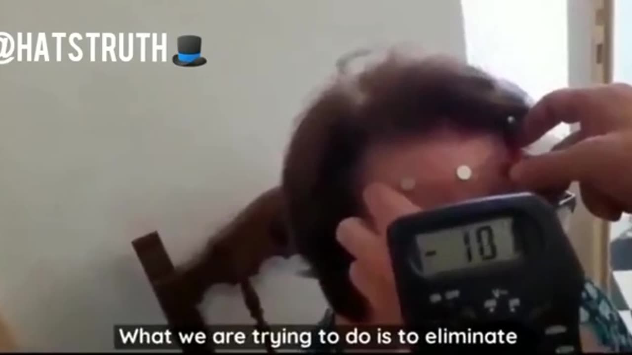 C19 Vaccine Injected... Graphene Oxide Magnetism in the Body Tested Proven.*3min*