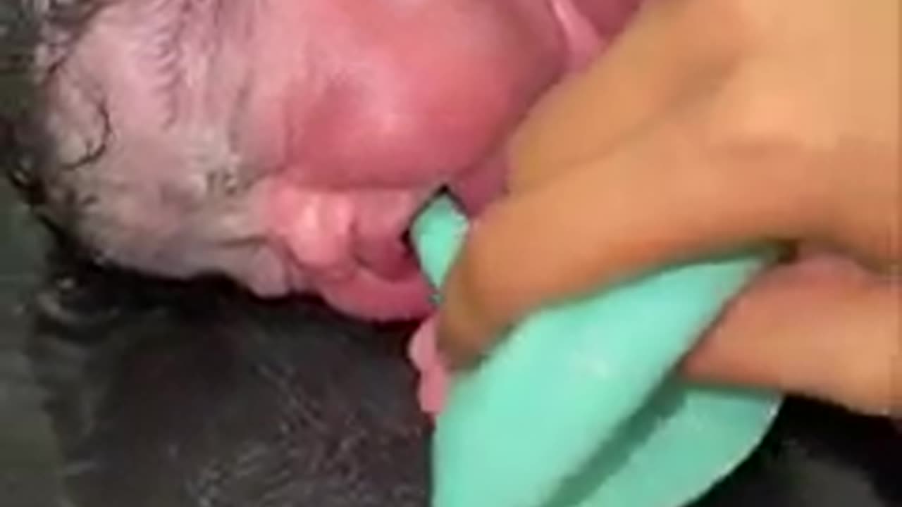 Treatment new born baby t20 cup funny earning