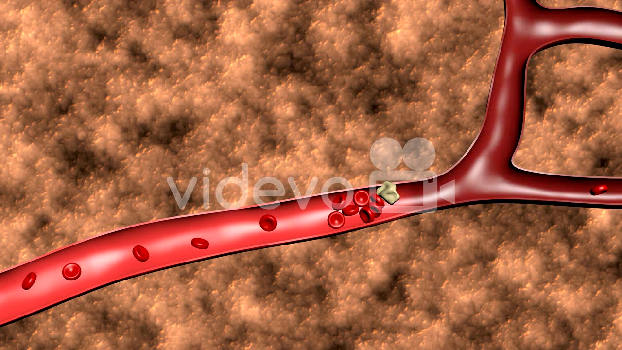 Blood vessels