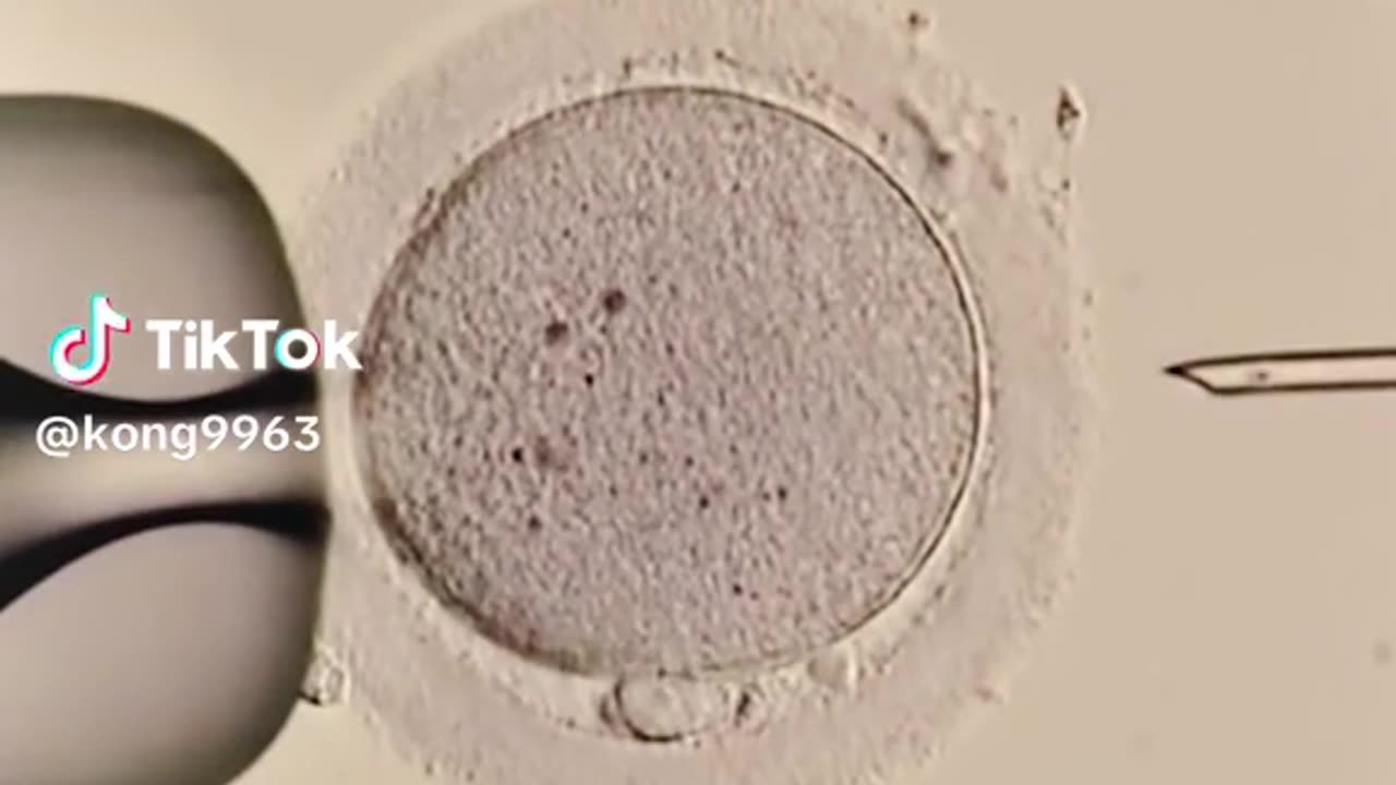 SPECTACULAR HUMAN IN-VITRO FERTILIZATION