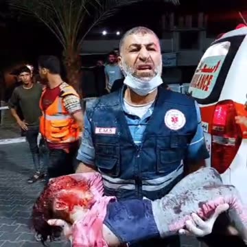 Palestinian Girl Head Split Open