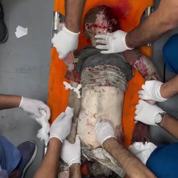 ►◾️ Warning extremely graphic! "most moral military" in the world DOES NOT CARE