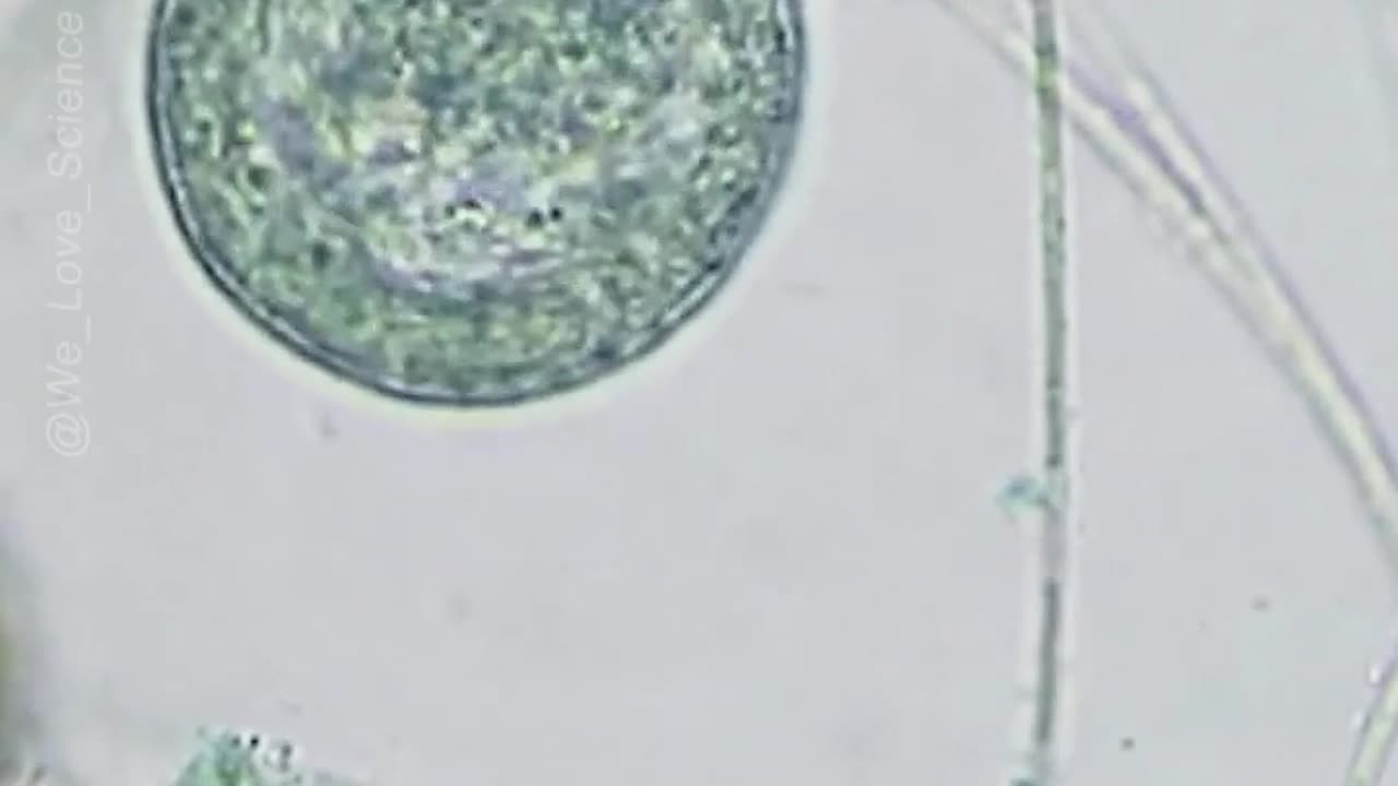 The Regeneration of Stentor coeruleus