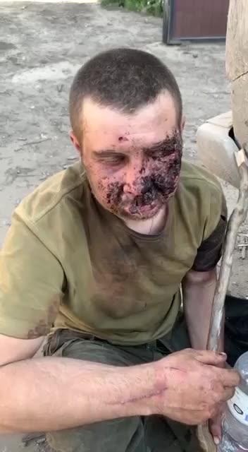 Russian Survives Grenade to the Face