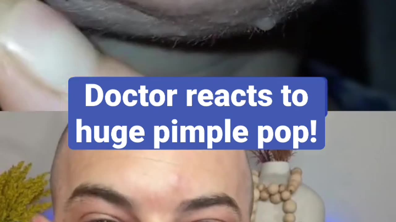 Doctor reacts to huge pimple pop!💥