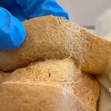 HOW DEEP DOES HAIR GO?