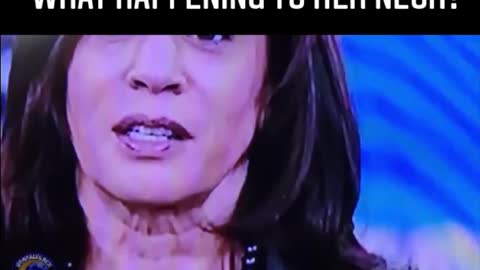 What Happened To Kamala's Neck?