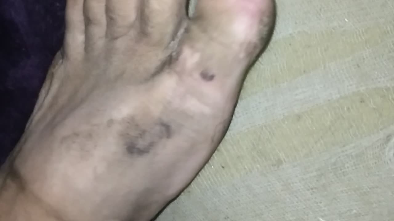 DIRTY FOOT HAVE AT IT FREAKS!