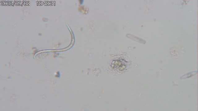Roundworm (Phylum Nematoda), 2022-09-08