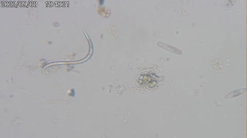 Roundworm (Phylum Nematoda), 2022-09-08