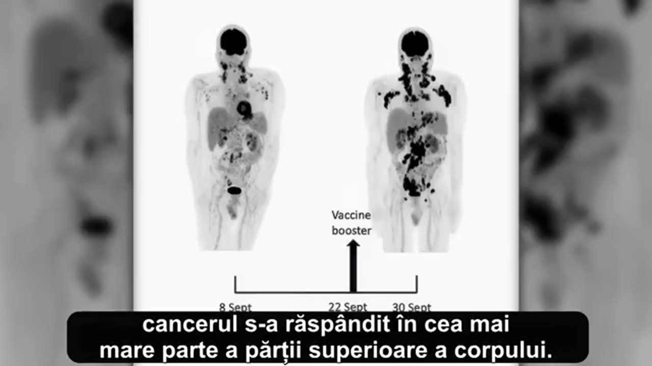 Nanoparticule în vaccinuri