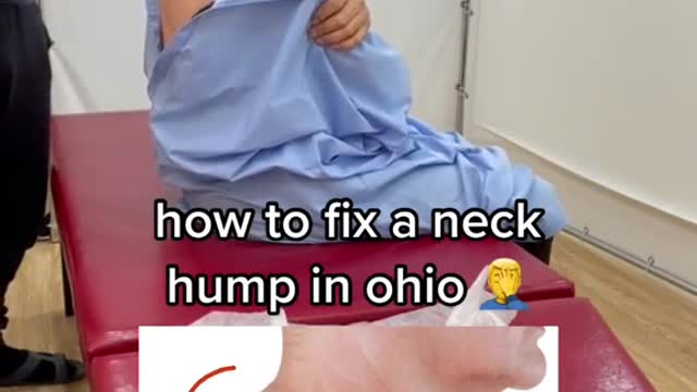 how to fix a neck hump in ohio