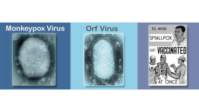 CDC MONKEYPOX UPDATE