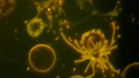 Alien Organisms in Blood Post Covid Vaccination - Bonus Videos At End 1000 Min. (Parasite Soup!)