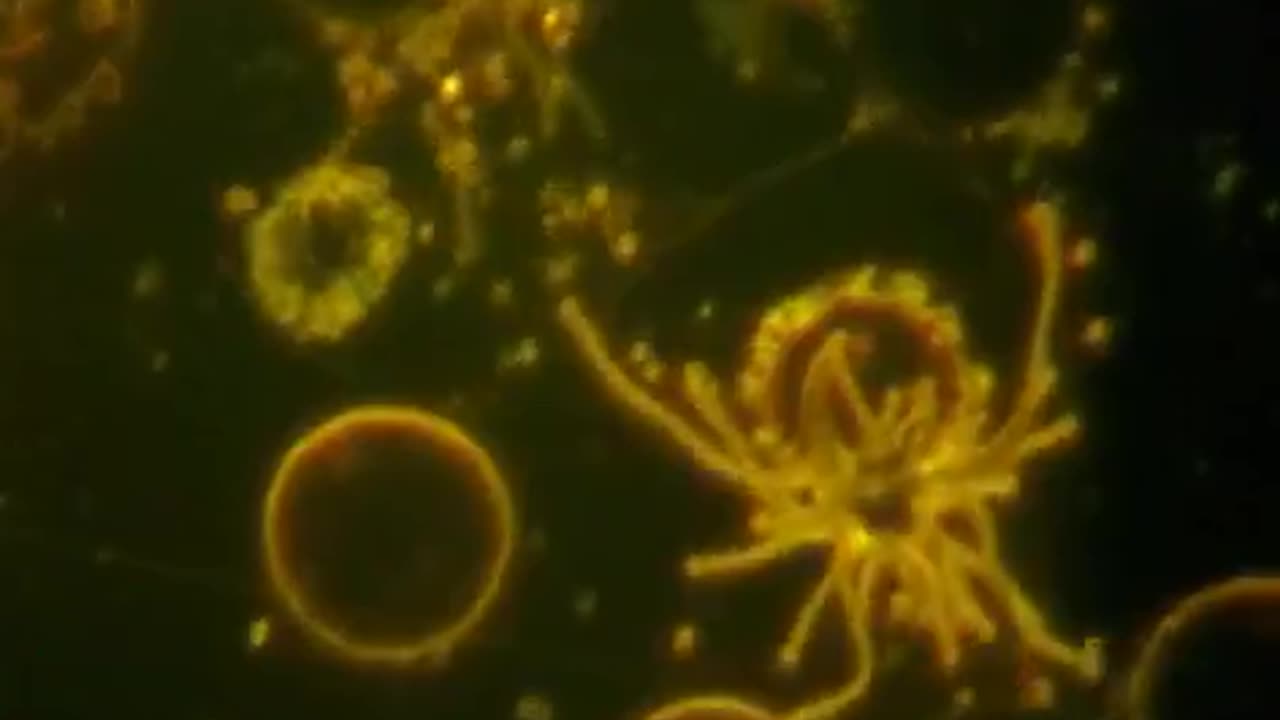 Alien Organisms in Blood Post Covid Vaccination - Bonus Videos At End 1000 Min. (Parasite Soup!)