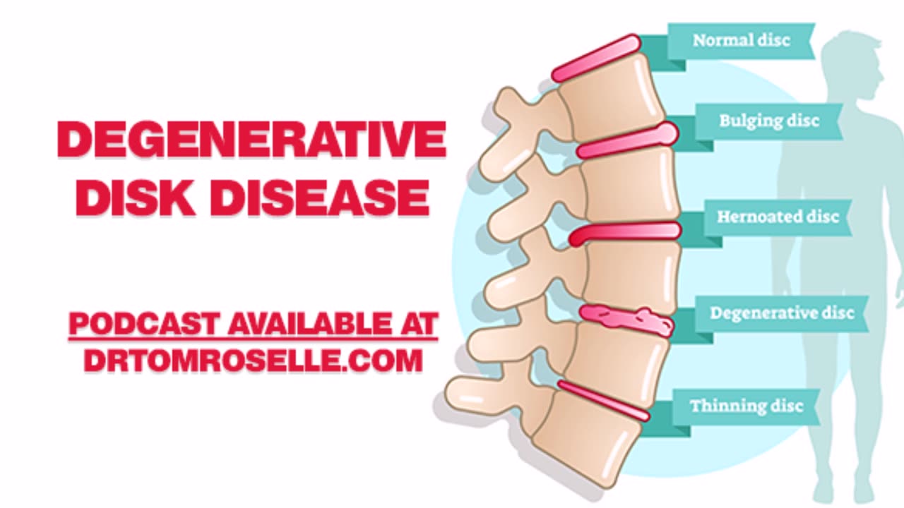 Degenerative Disk Disease