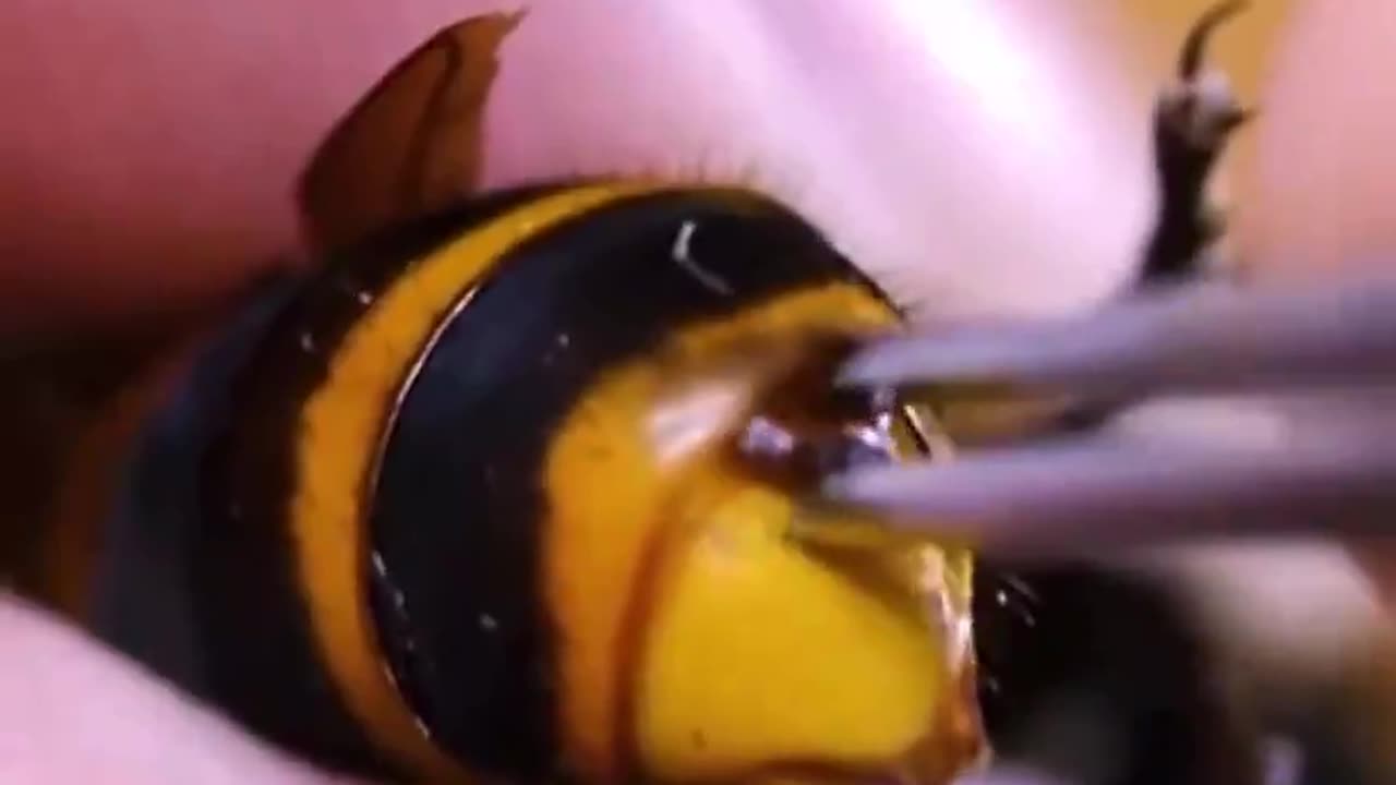 Man pulls parasite from wasp's stomach