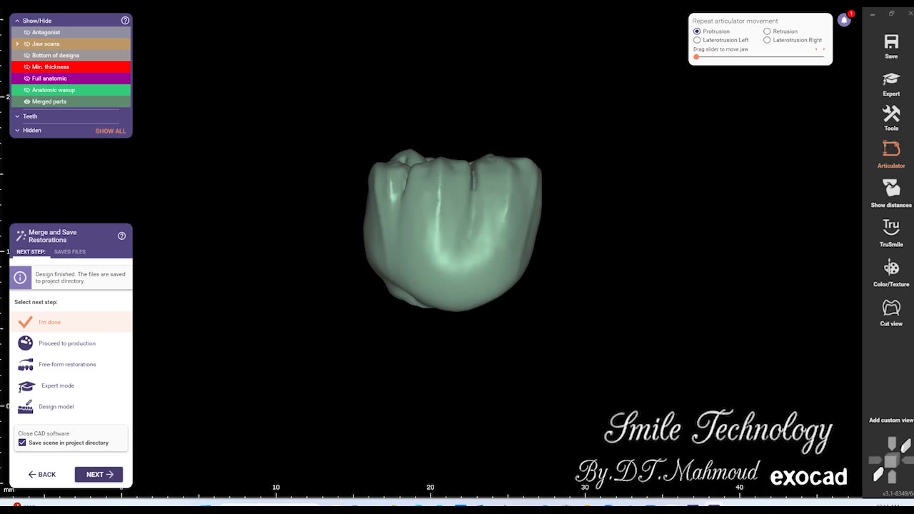 #design #naildesign #dental #dentaldesign #exocadexpert