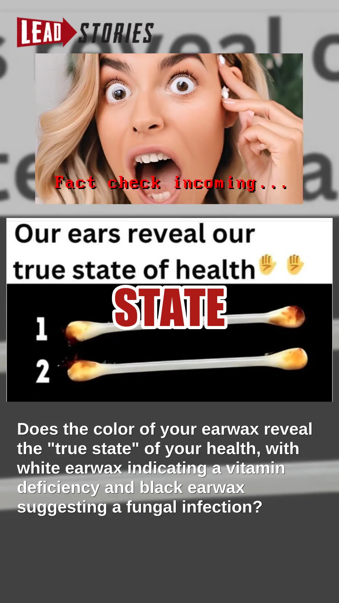 Fact Check: Earwax Color Does NOT Reveal 'True State' Of Your Health